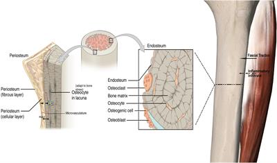 The Effect of Inflammation on Bone